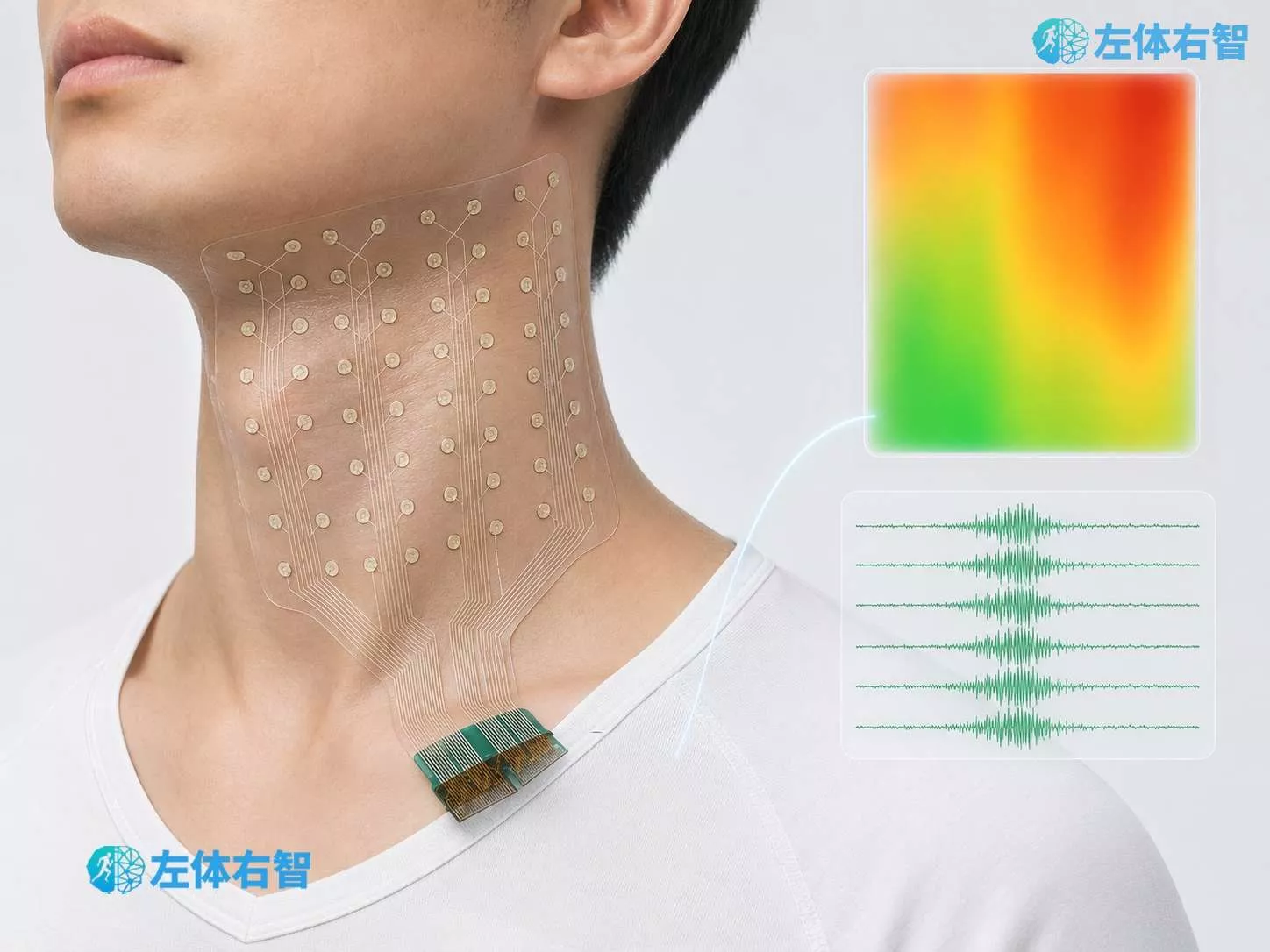 柔性可拉伸高密度表面肌电电极